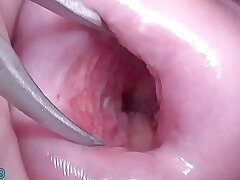 Japanese MILF's Open Cervix Gets Pinned